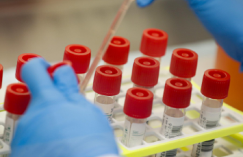 A photo of a scientist applying samples to test vials 