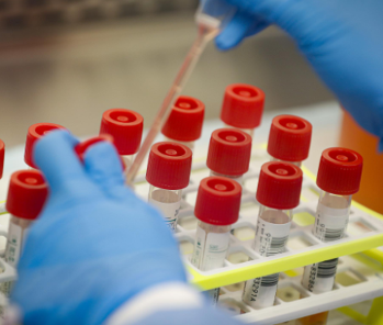 A photo of a scientist applying samples to test vials